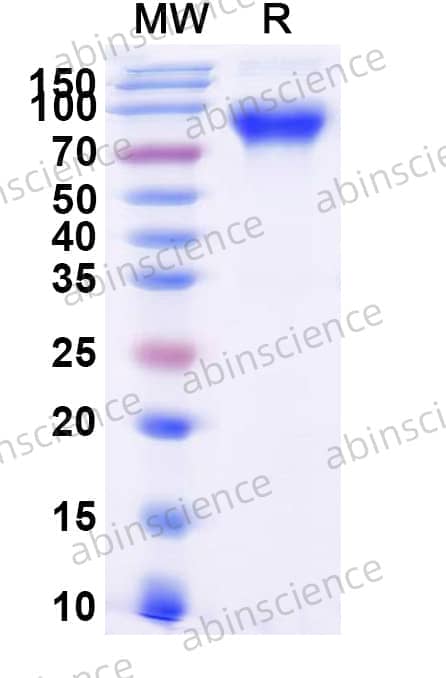 Human CD87/PLAUR/uPAR Recombinant Protein (C-Fc)