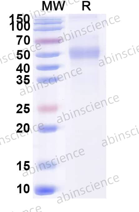 Recombinant Human CD87/PLAUR/uPAR Protein, C-His