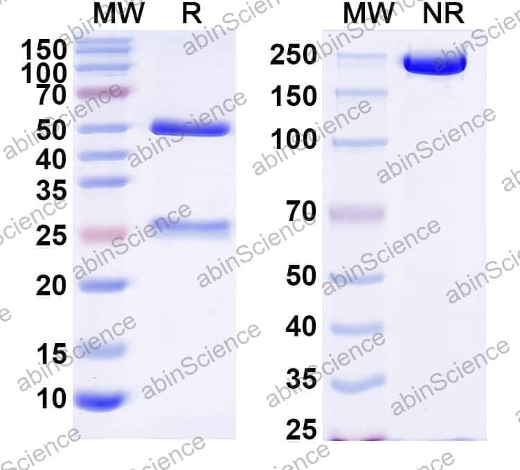 Anti-Human CD87/PLAUR/uPAR Recombinant Antibody (8B12)
