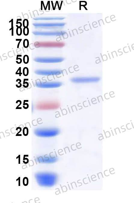 Human NY-ESO-1 Recombinant Protein (N-GST & C-His)