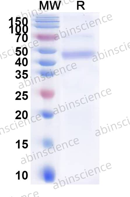 Human NRG1&beta;1 Recombinant Protein (C-His)