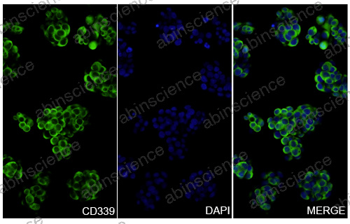 Anti-Human CD339/JAG1 Recombinant Nanobody (SAA1285)