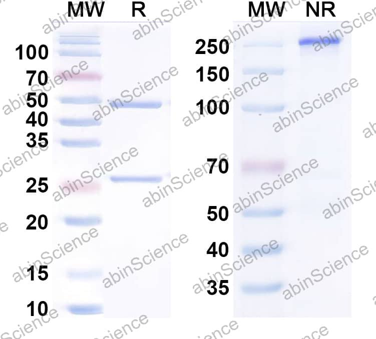 Anti-IL1RL1/ST2 Recombinant Antibody (TQC2938) (TQC2938)