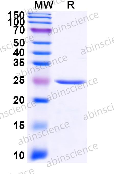 Human CDH13 Recombinant Protein (N-His)