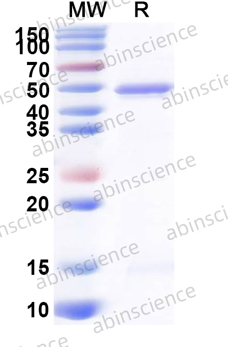 Human MAPK10 Recombinant Protein (N-His)