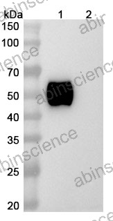 Research Grade Epacmarstobart