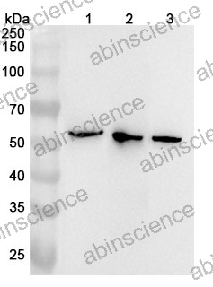 Anti-OXCT1 Polyclonal Antibody