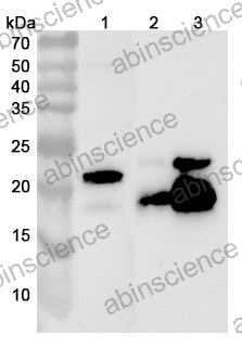 Anti-TAGLN Polyclonal Antibody