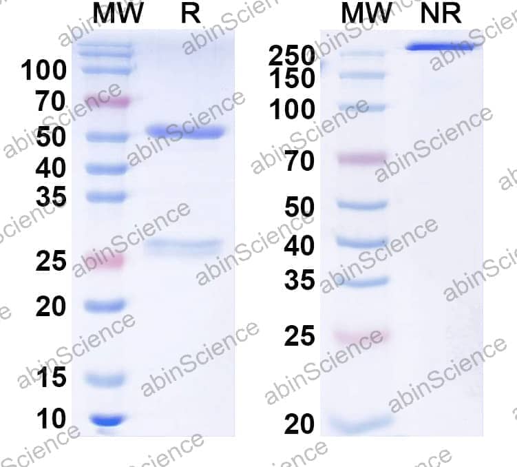 Anti-Kir2.1 K+ channel Recombinant Antibody (N112/16)