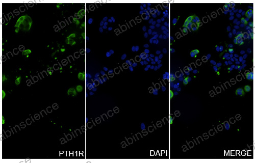 Anti-Human PTH1R Recombinant Nanobody (SAA0797)
