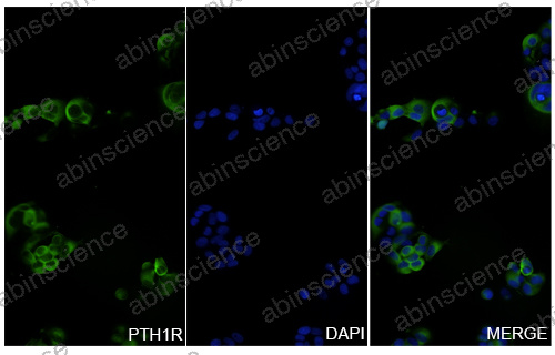 Anti-Human PTH1R Recombinant Nanobody (SAA1275)