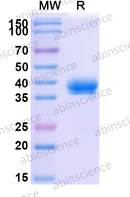 Human CD269/TNFRSF17/BCMA Recombinant Protein (C-Fc-Avi), Biotin