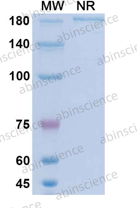 Anti-Human CD14 Recombinant Antibody (F1024D)