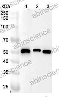 Anti-Human TP53 Polyclonal Antibody