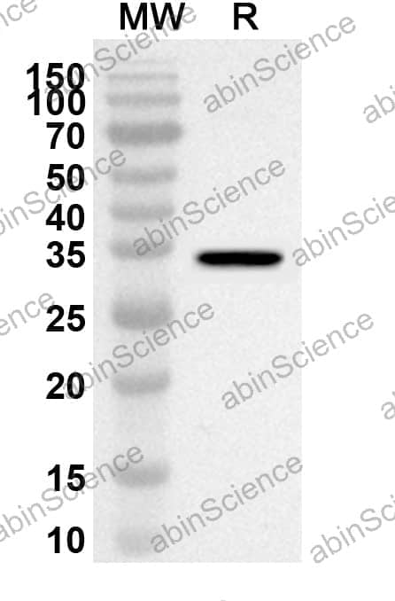 Anti-Human CD1A Polyclonal Antibody