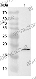 Anti-TTR Polyclonal Antibody