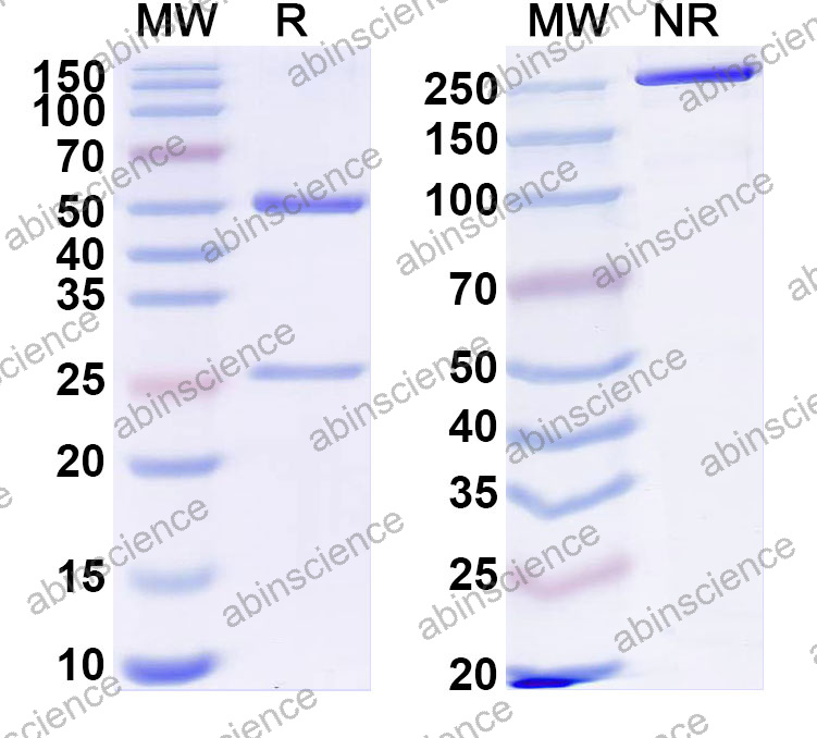 Anti-Human CD5 Antibody (5D7)