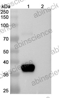 Anti-Human IGF1 Recombinant Antibody (SAA0432)