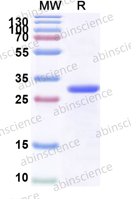 Human WNT2 Recombinant Protein (N-His)
