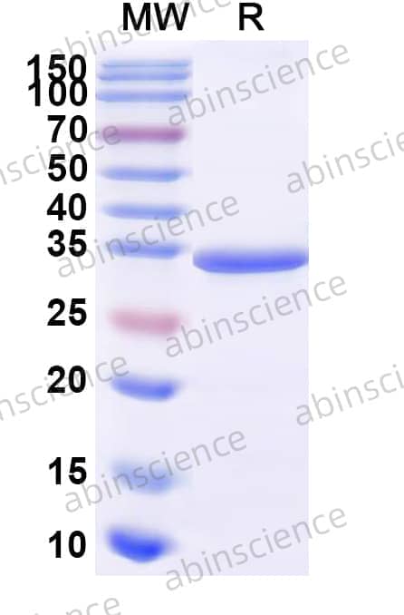 Recombinant Human CD117/KIT Protein, C-Fc