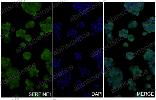 Anti-Human SERPINE1/PAI-1 Recombinant Nanobody (SAA1079)