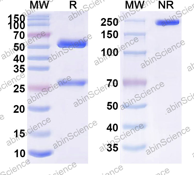 Anti-Human ANXA1 Monoclonal Antibody (1A506)