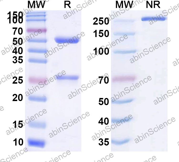Anti-Human ANXA1 Monoclonal Antibody (1A507)