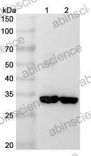 Anti-RLBP1 Polyclonal Antibody