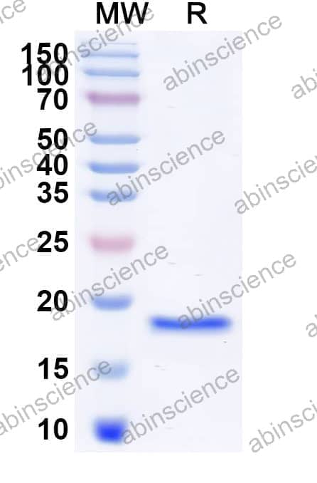 Human FGF1 Recombinant Protein (C-His)