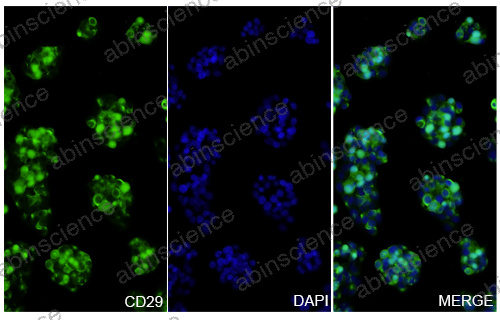Anti-Human Integrin beta 1/CD29 Recombinant Nanobody (SAA1306)