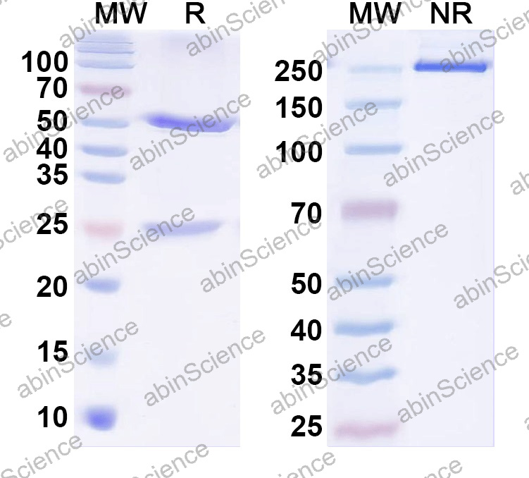 Anti-Human MAP2 Monoclonal Antibody (1A559)