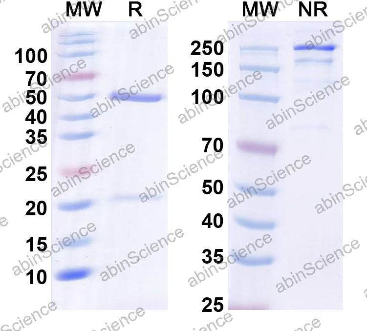 Anti-Human MAP2 Monoclonal Antibody (1A560)
