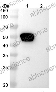 Anti-Human Fibronectin Reference Antibody (Micvotabart, RUO)