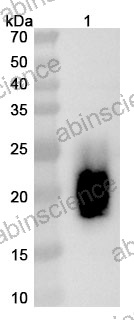 Anti-Human IL3 Recombinant Antibody (SAA1520)