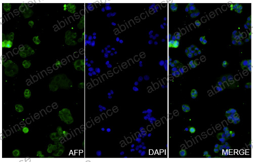 Anti-Human alpha-Fetoprotein/AFP Recombinant Antibody (AF5)