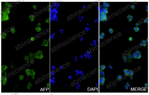 Anti-Human alpha-Fetoprotein/AFP Reference Antibody (Tacatuzumab, RUO)