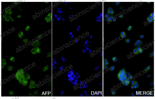 Anti-Human alpha-Fetoprotein/AFP Monoclonal Antibody (1A179)
