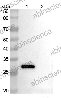 Anti-Human SLPI Recombinant Antibody (SAA1833)
