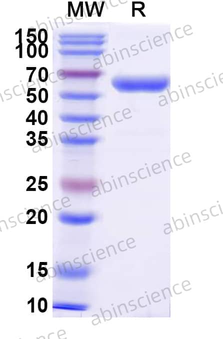 Human CD7 Recombinant Protein (C-Fc)