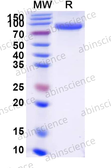 Human CD55/DAF Recombinant Protein (C-Fc)