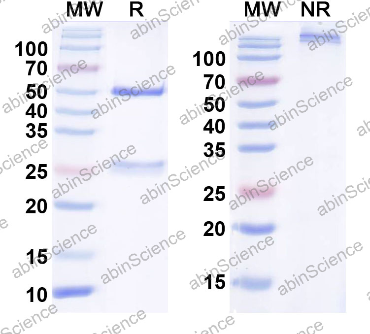 Anti-Human CD56/NCAM1 Monoclonal Antibody (1A485)