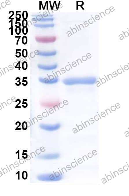 Human CCL3/MIP-1-alpha Recombinant Protein (N-GST & C-His)
