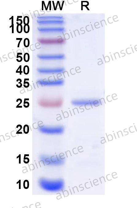 Human ELANE Recombinant Protein (N-His)