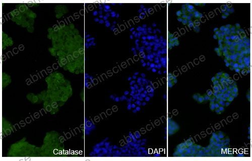 Anti-Human CAT/Catalase Recombinant Nanobody (SAA1202)