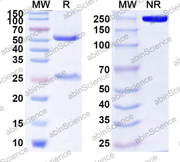 Anti-Human CD271/NGFR Monoclonal Antibody (1A634)