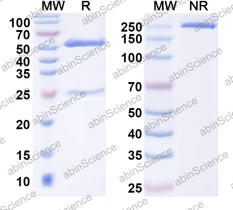 Anti-Human KRT10 Monoclonal Antibody (1A581)