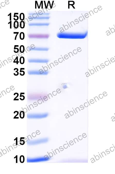 Native Human ALB/Albumin Protein