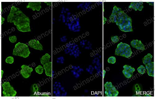 Anti-Human ALB Recombinant Nanobody (SAA1019)