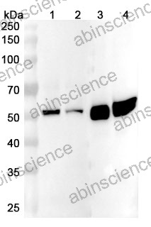 Anti-Human ALDH2 Polyclonal Antibody