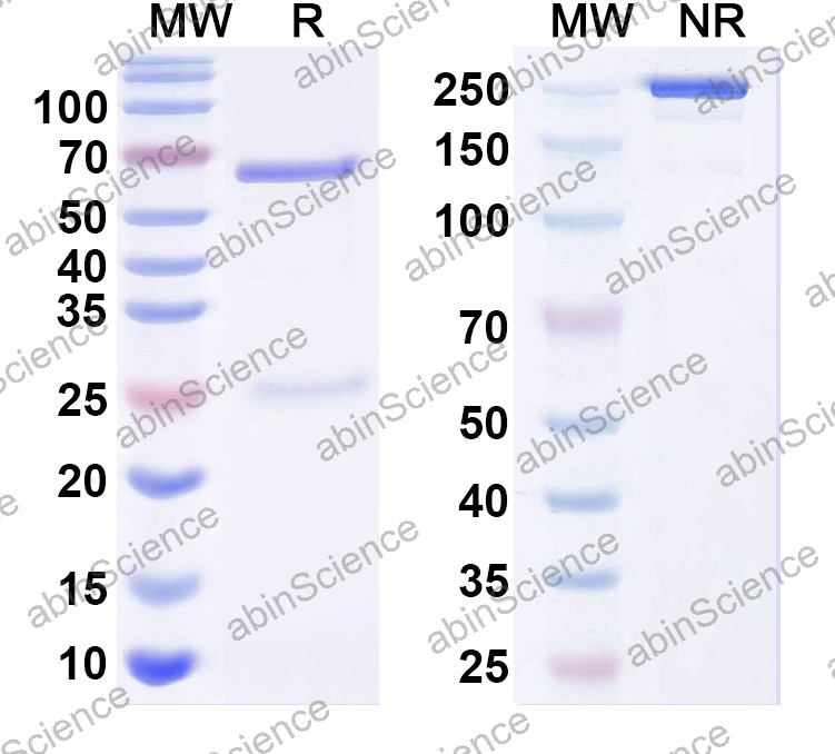 Anti-Human PIP Monoclonal Antibody (1A568)